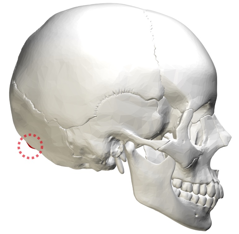 DDR-External_occipital_protuberance