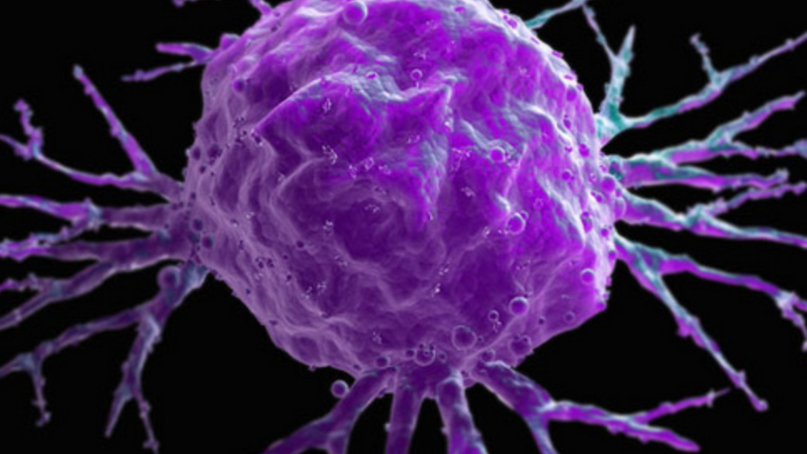 cancer_cell_flickr