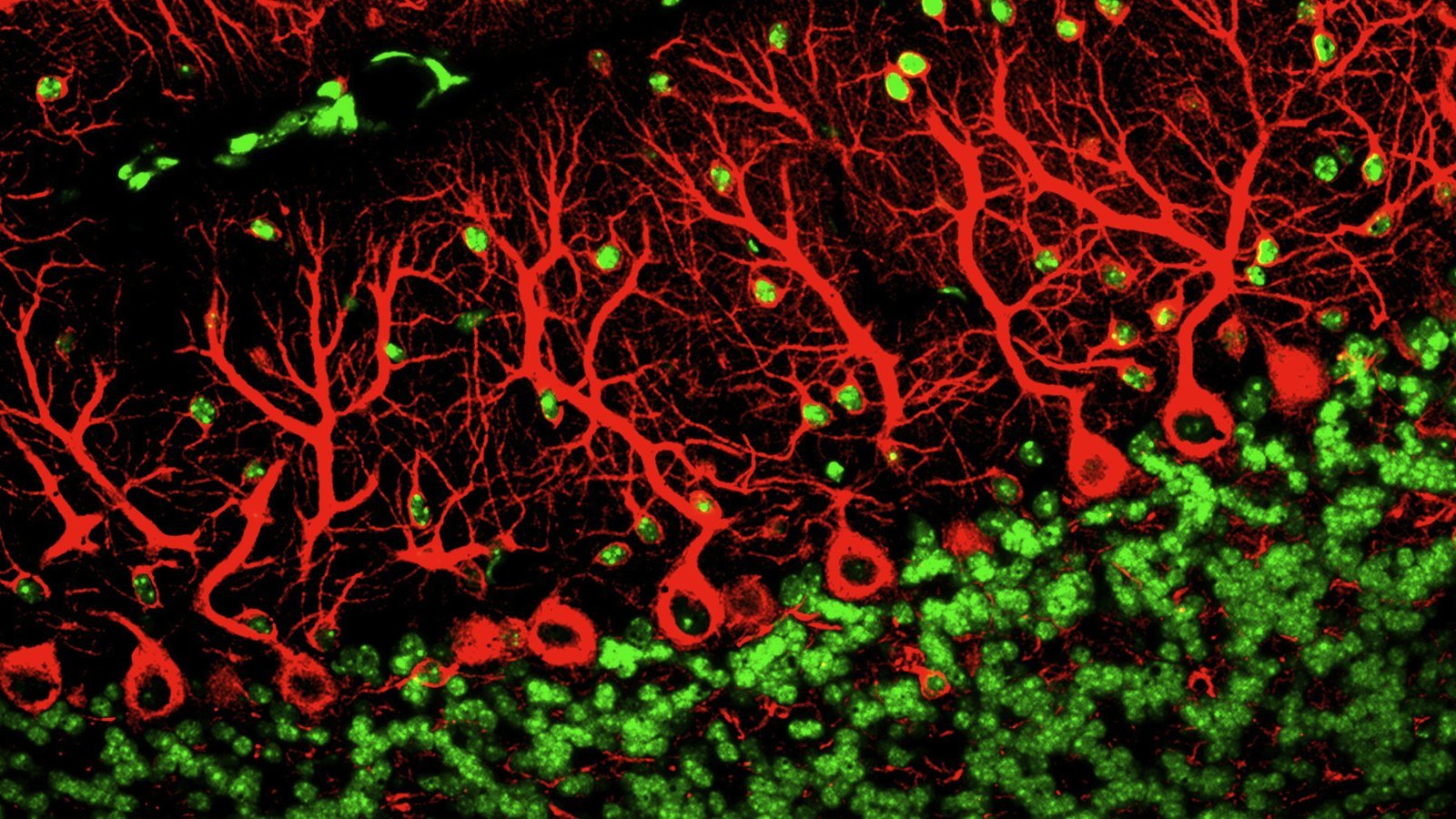 cerveau-cellulesPurkinje