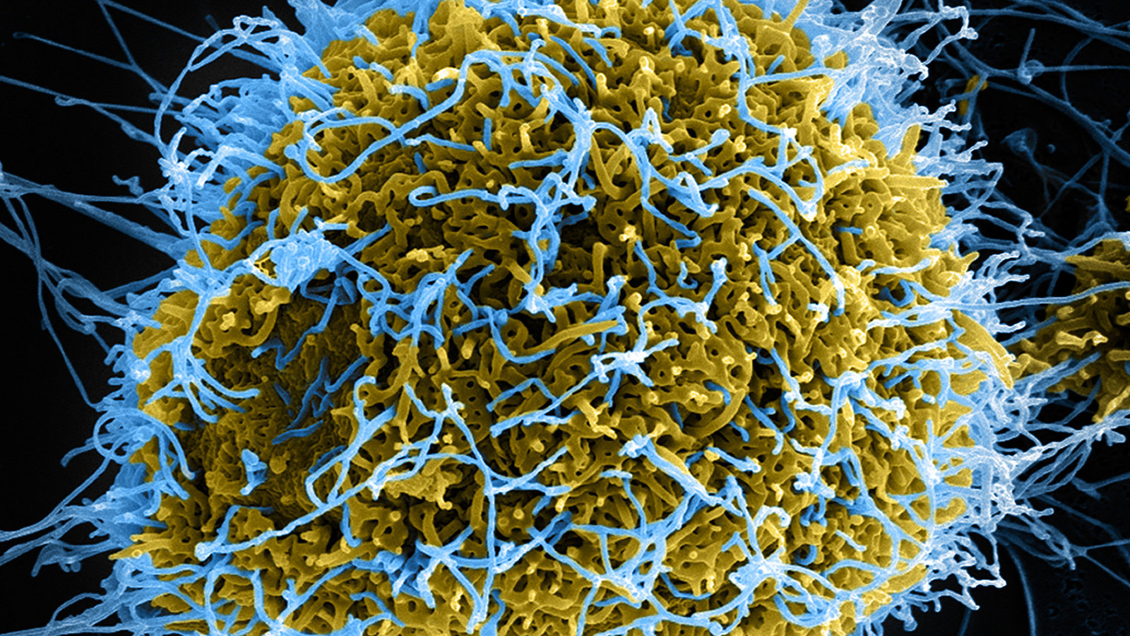 ebola-cellule