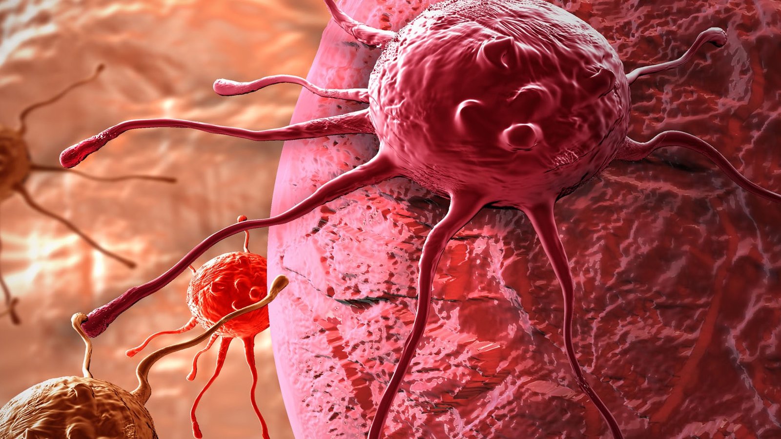 cancer-cellule