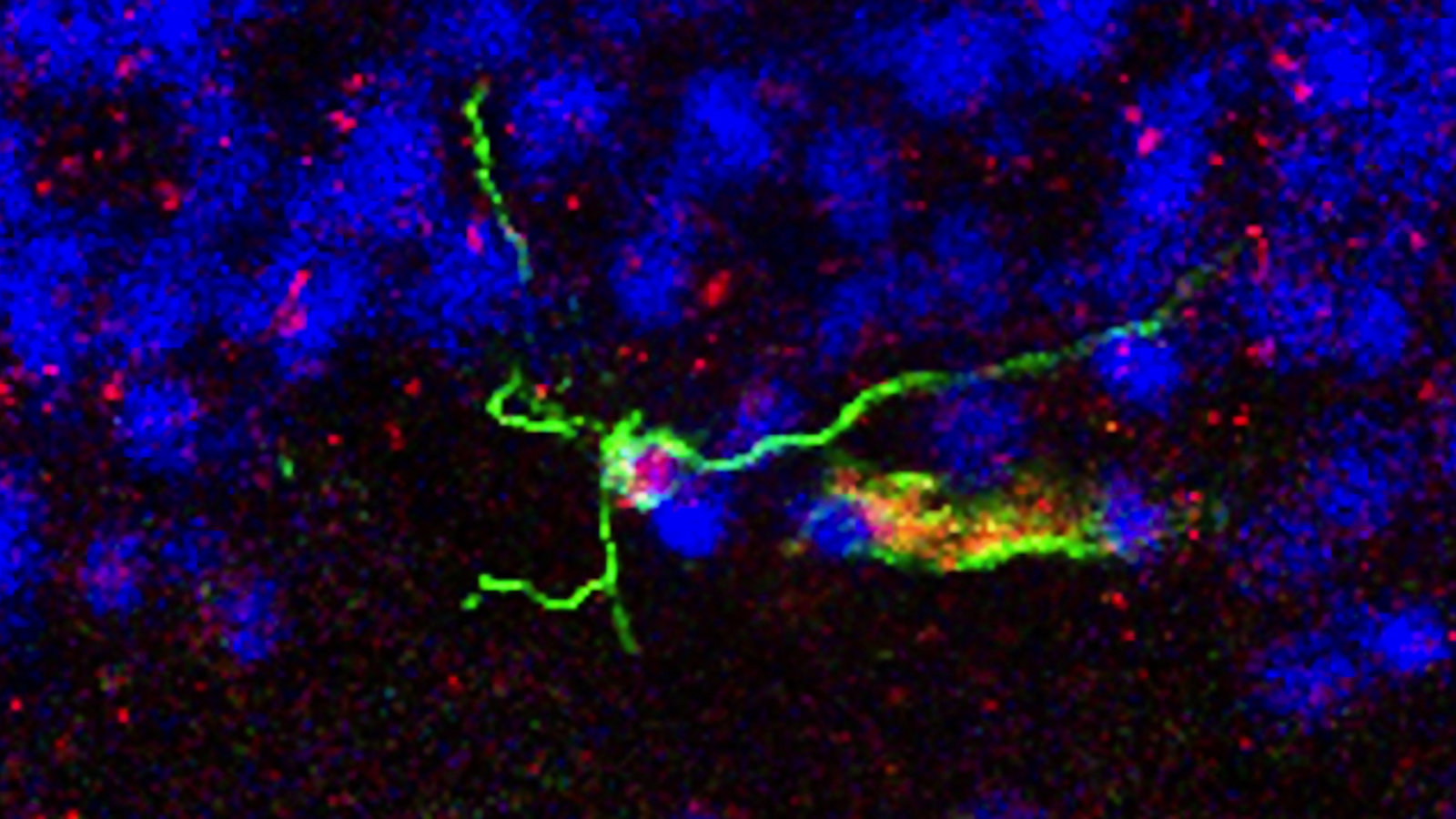 neurogenèse-Boldrini