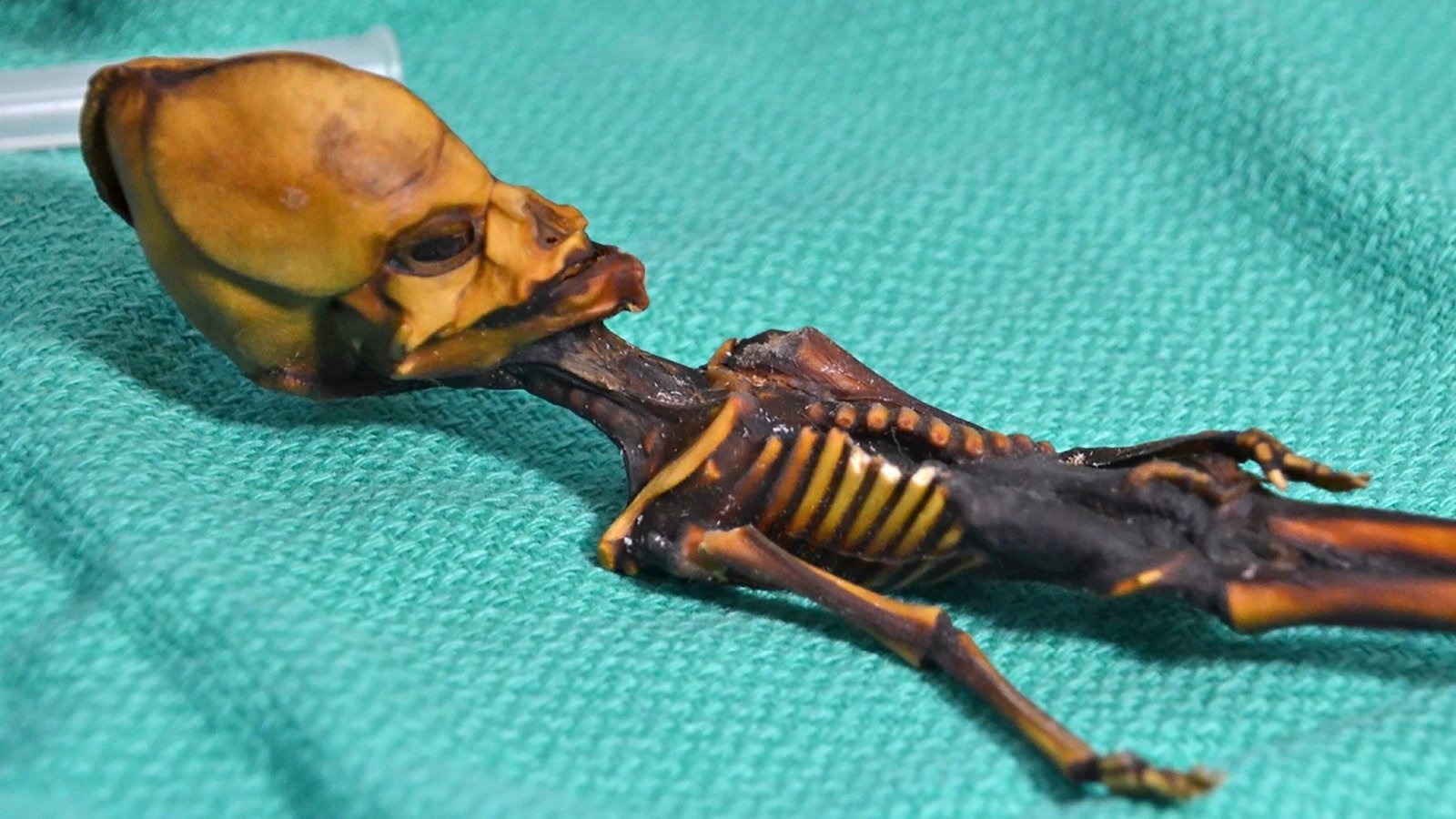 squelette-Atacama-fille