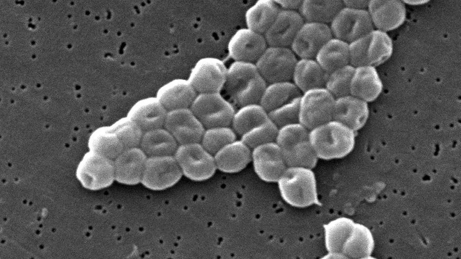 Acinetobacter.JPG (246.75 Ko) 