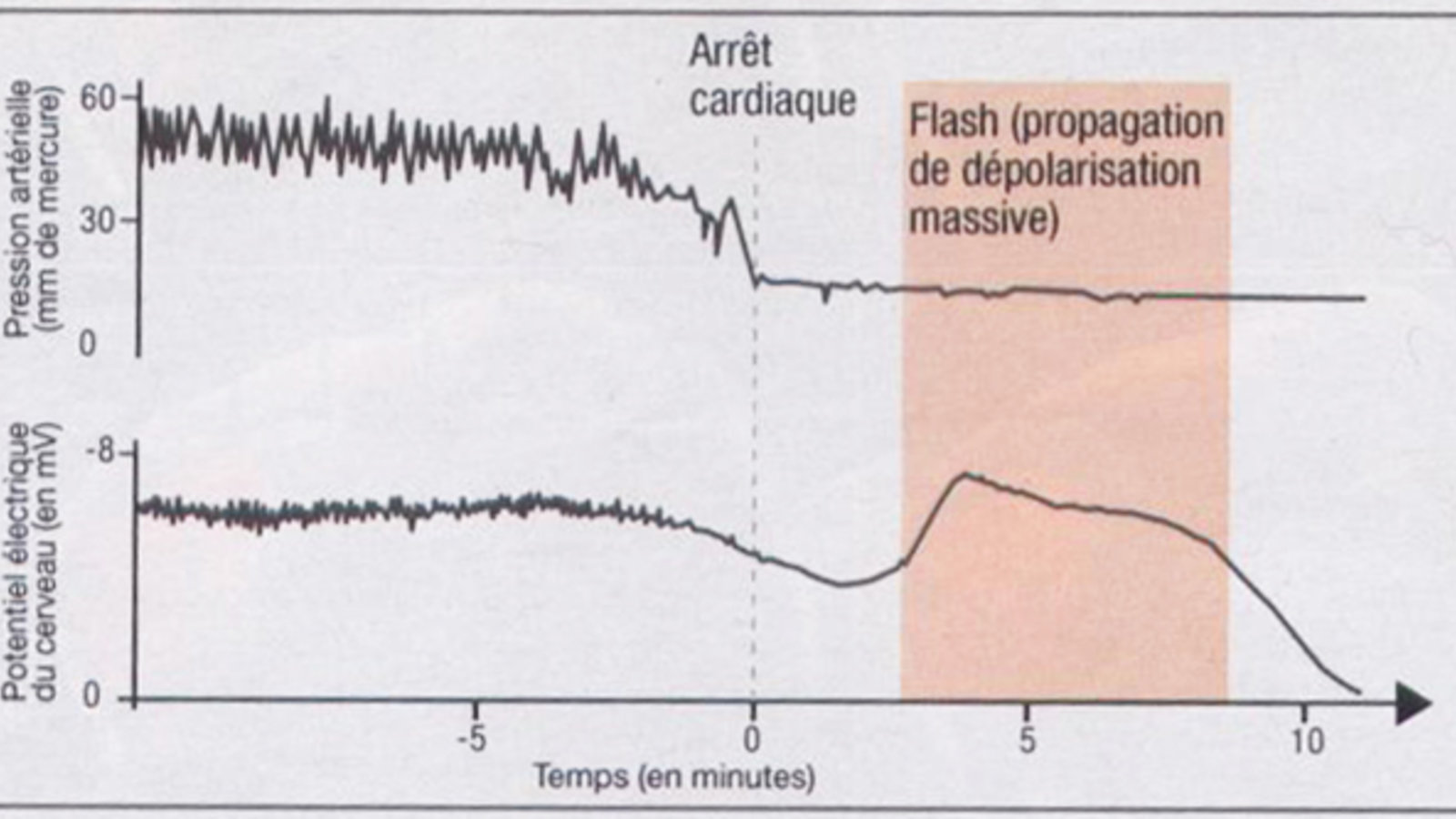 vague dépolarisation