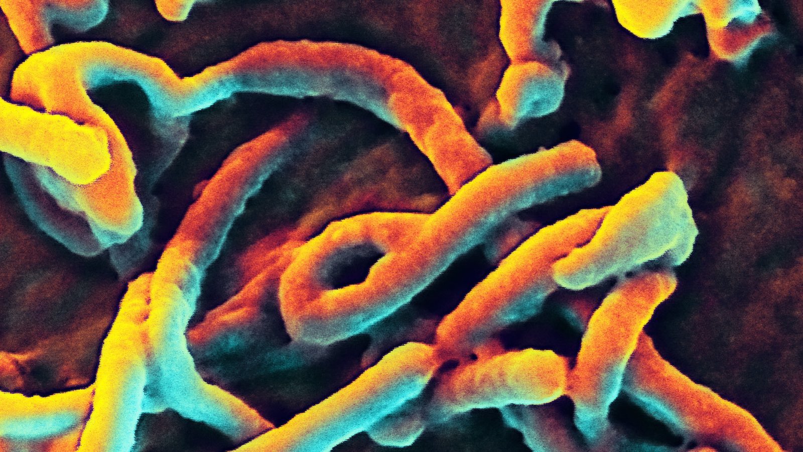 Ebola-microscopeelectronique