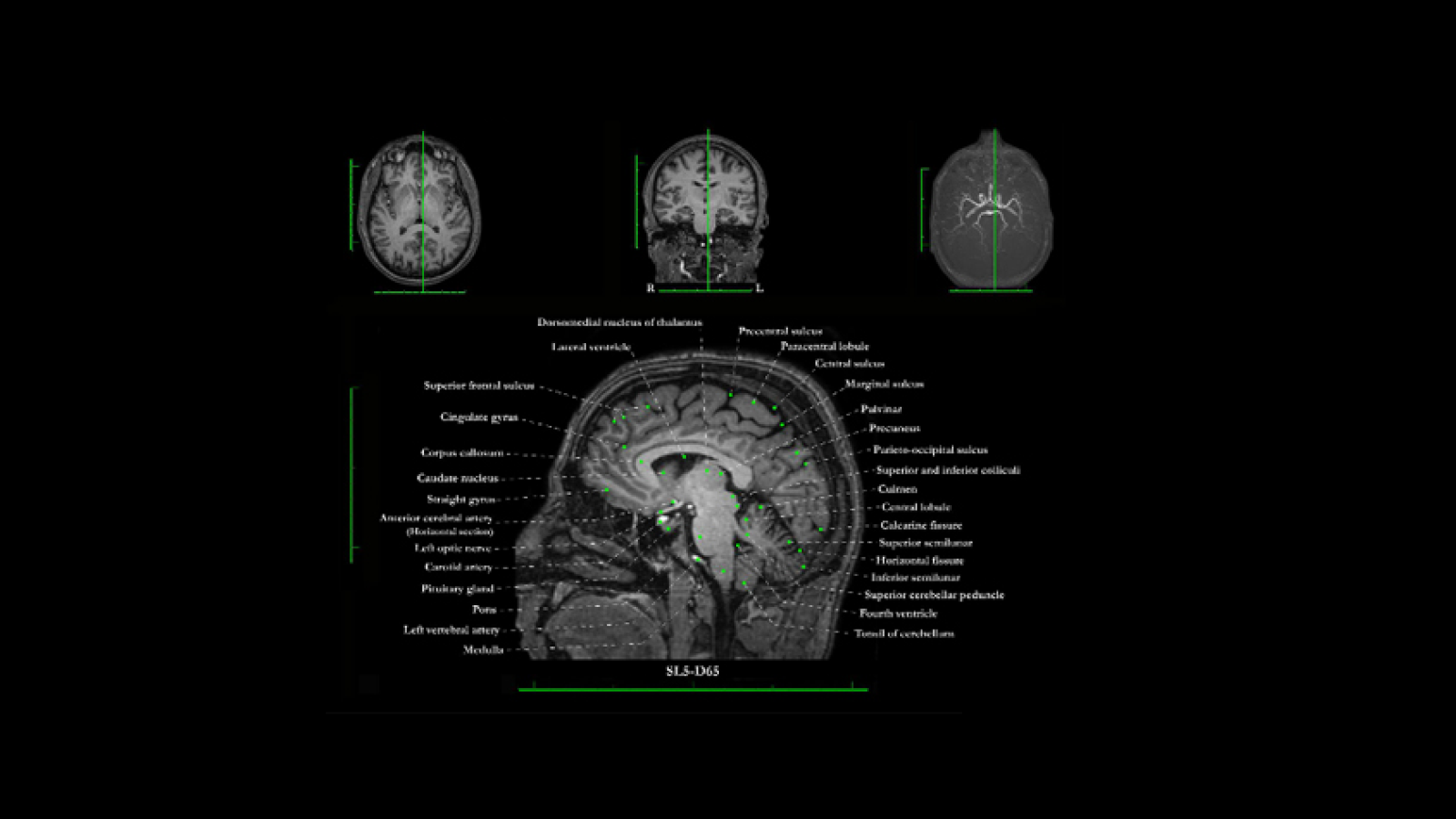 cerveau3.png (340.55 Ko) 