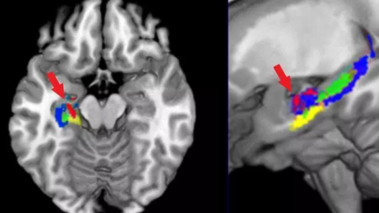 La trace de nos apprentissages observée dans l'hippocampe et le cortex