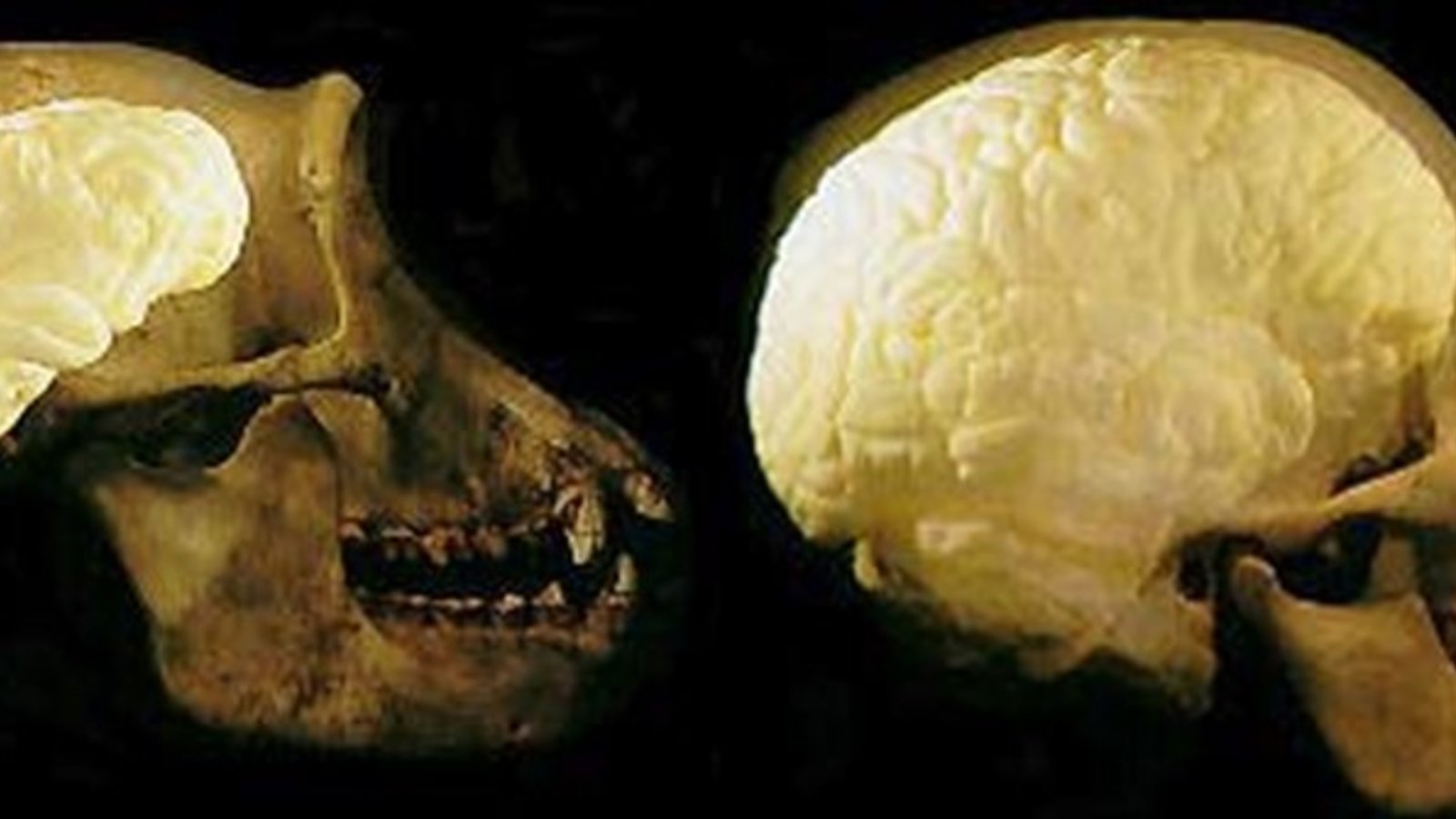brain chimp human