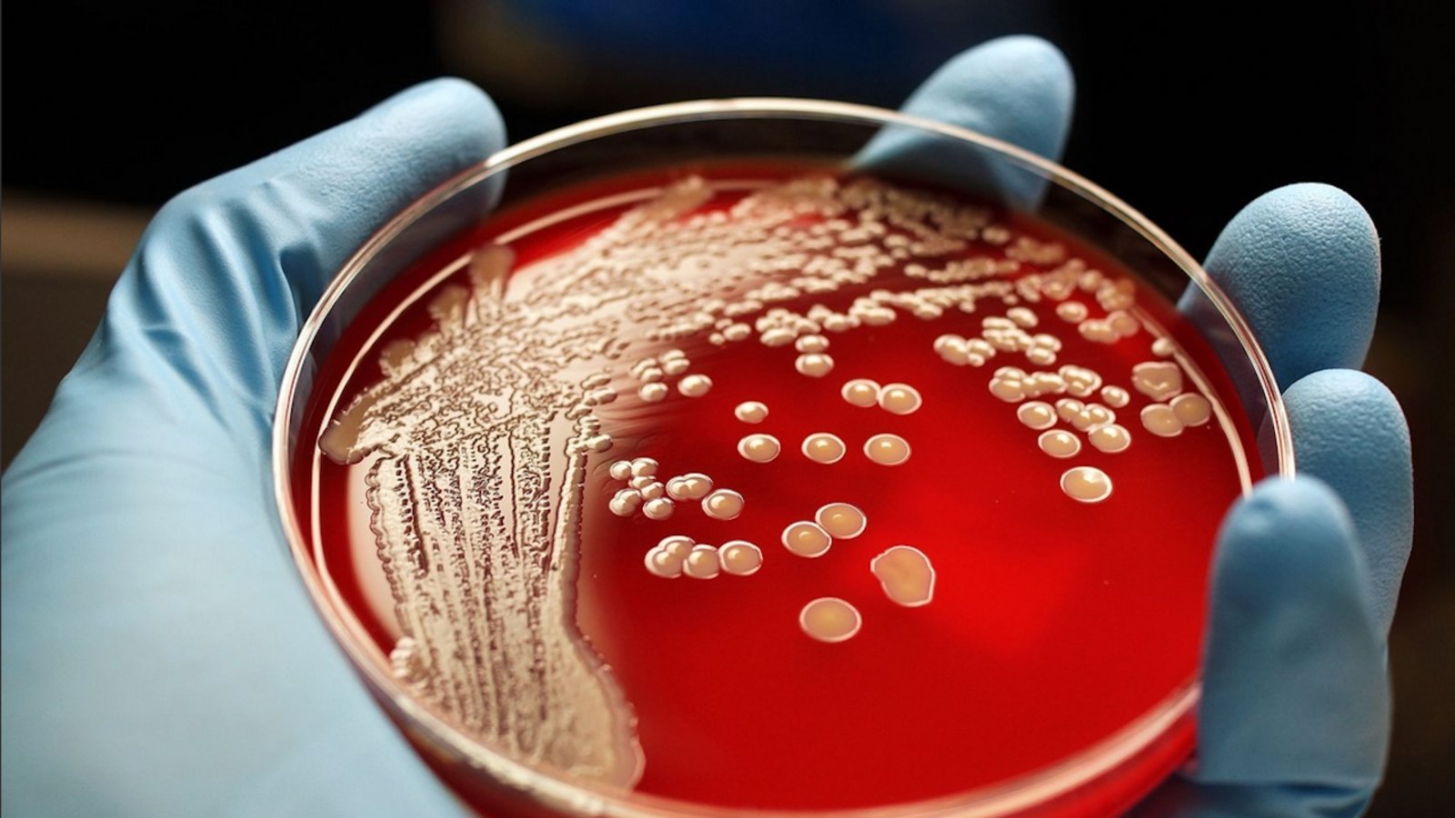 bacteries-petri-dish