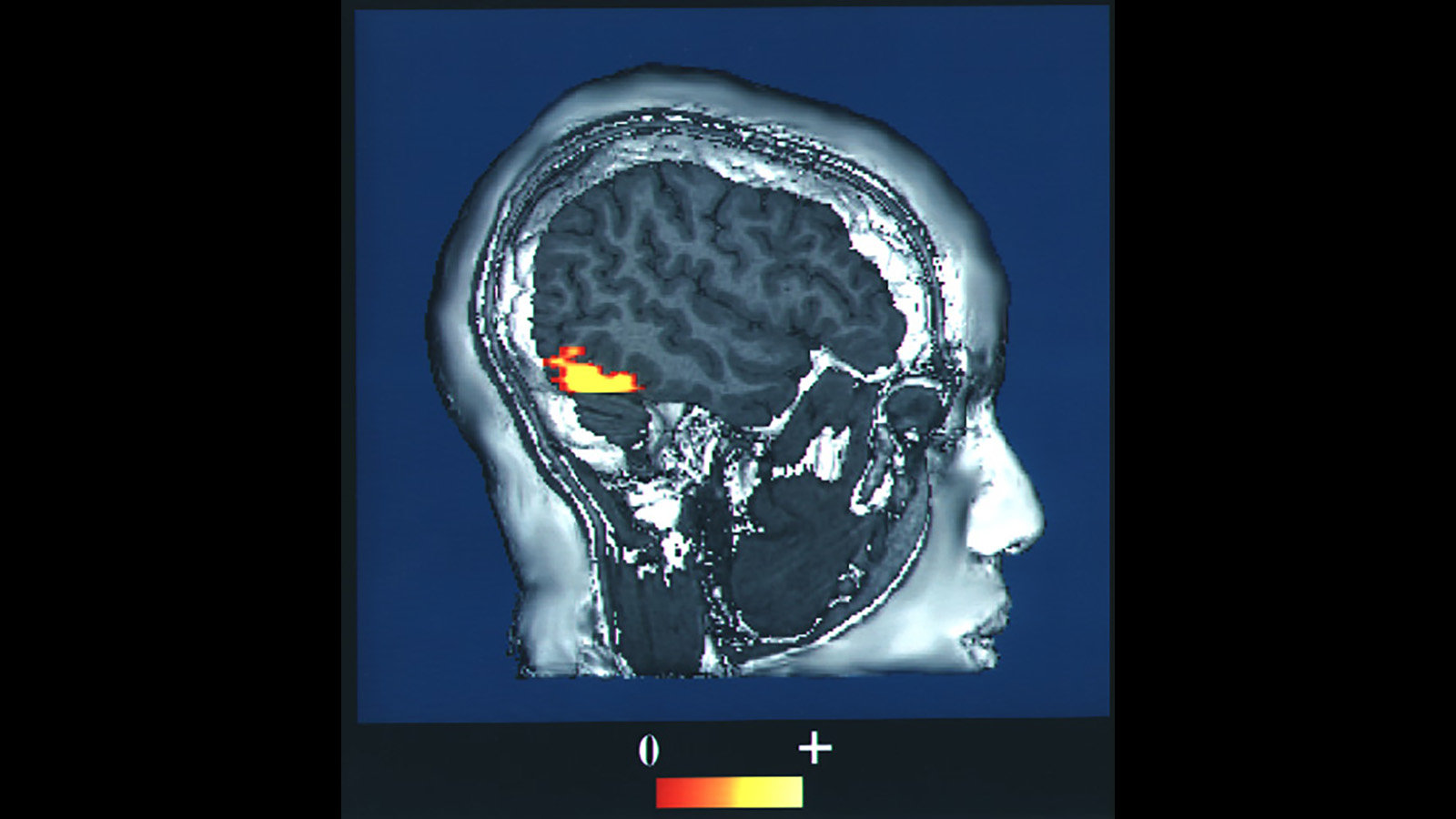 cerveau