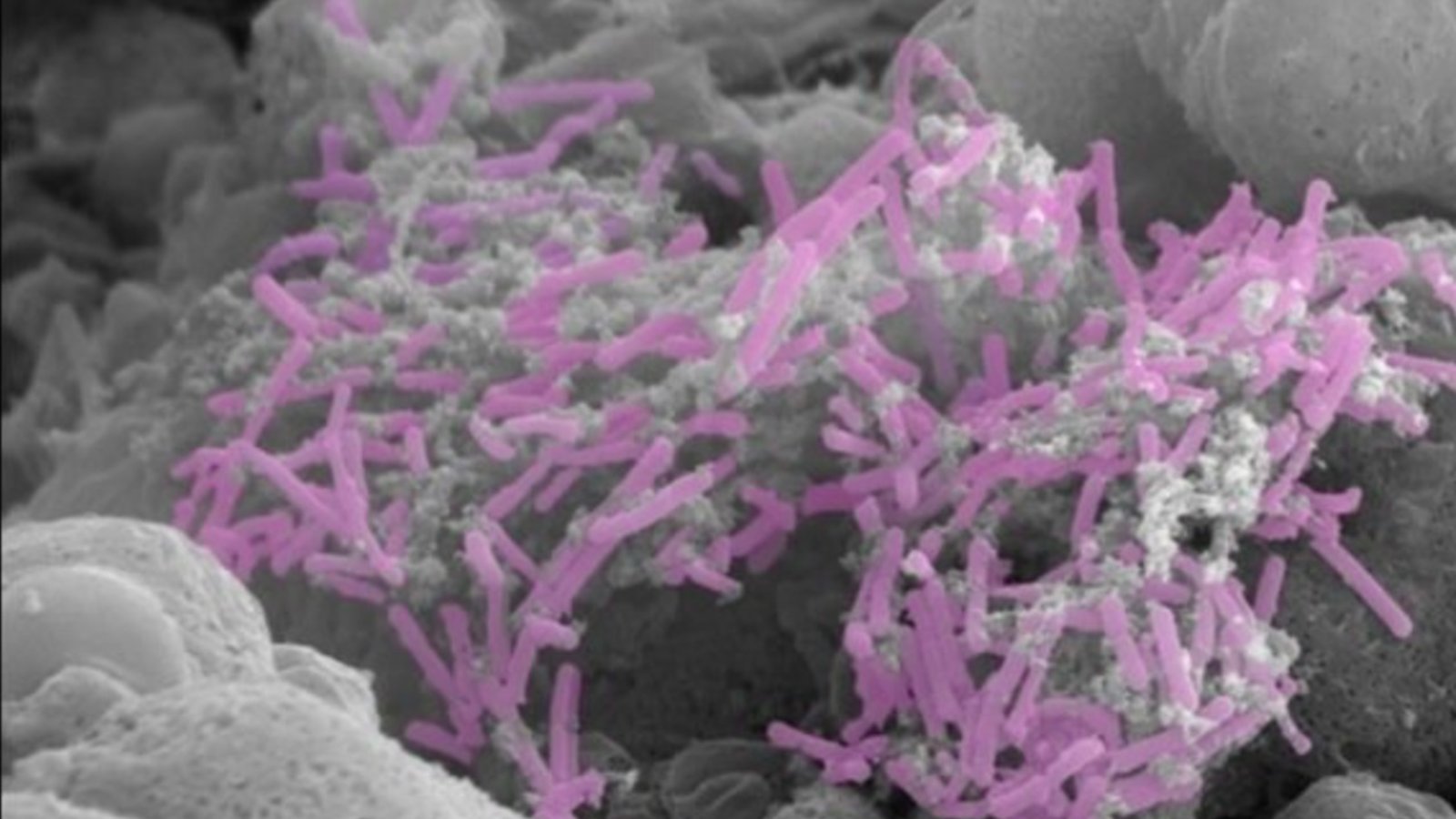 Bacterie-Lactobacillus_crispatus