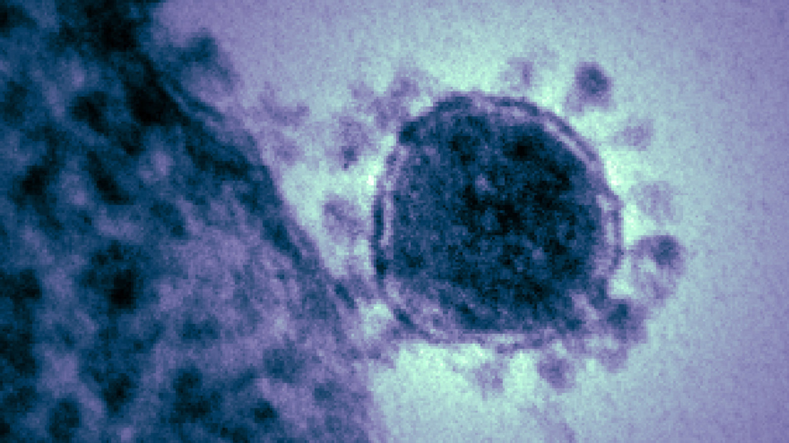 coronavirus