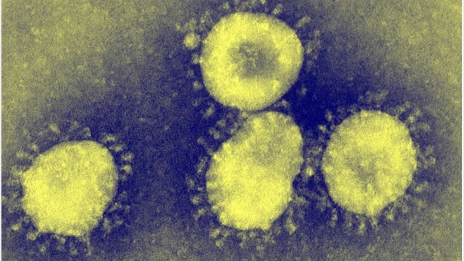 coronavirus