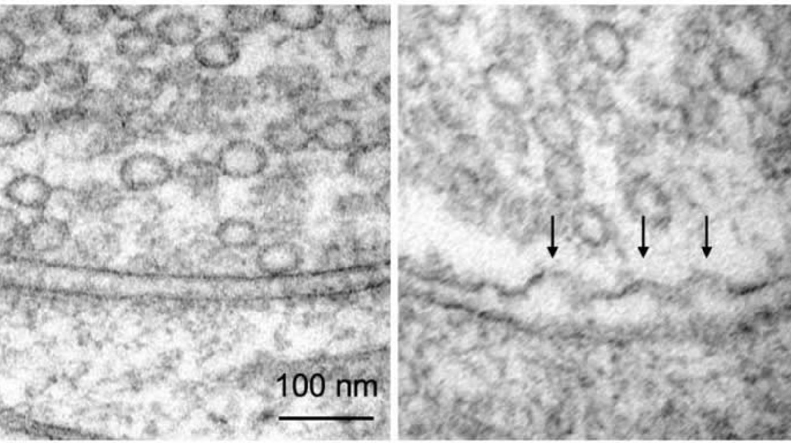 synapse-neurotransmission-neurosicnews.jpg