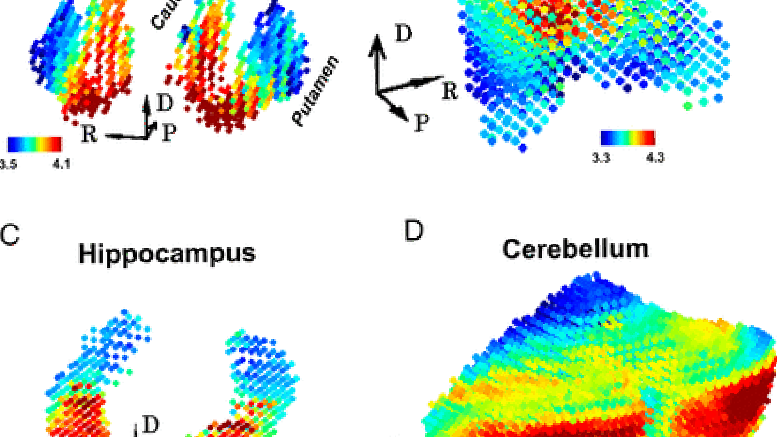 structures sous-corticale.png