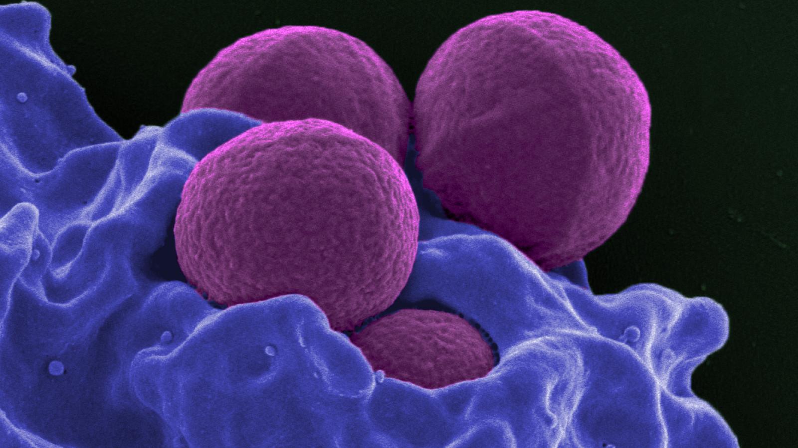 Neutrophile humain ingérant des staphylocoques dorés