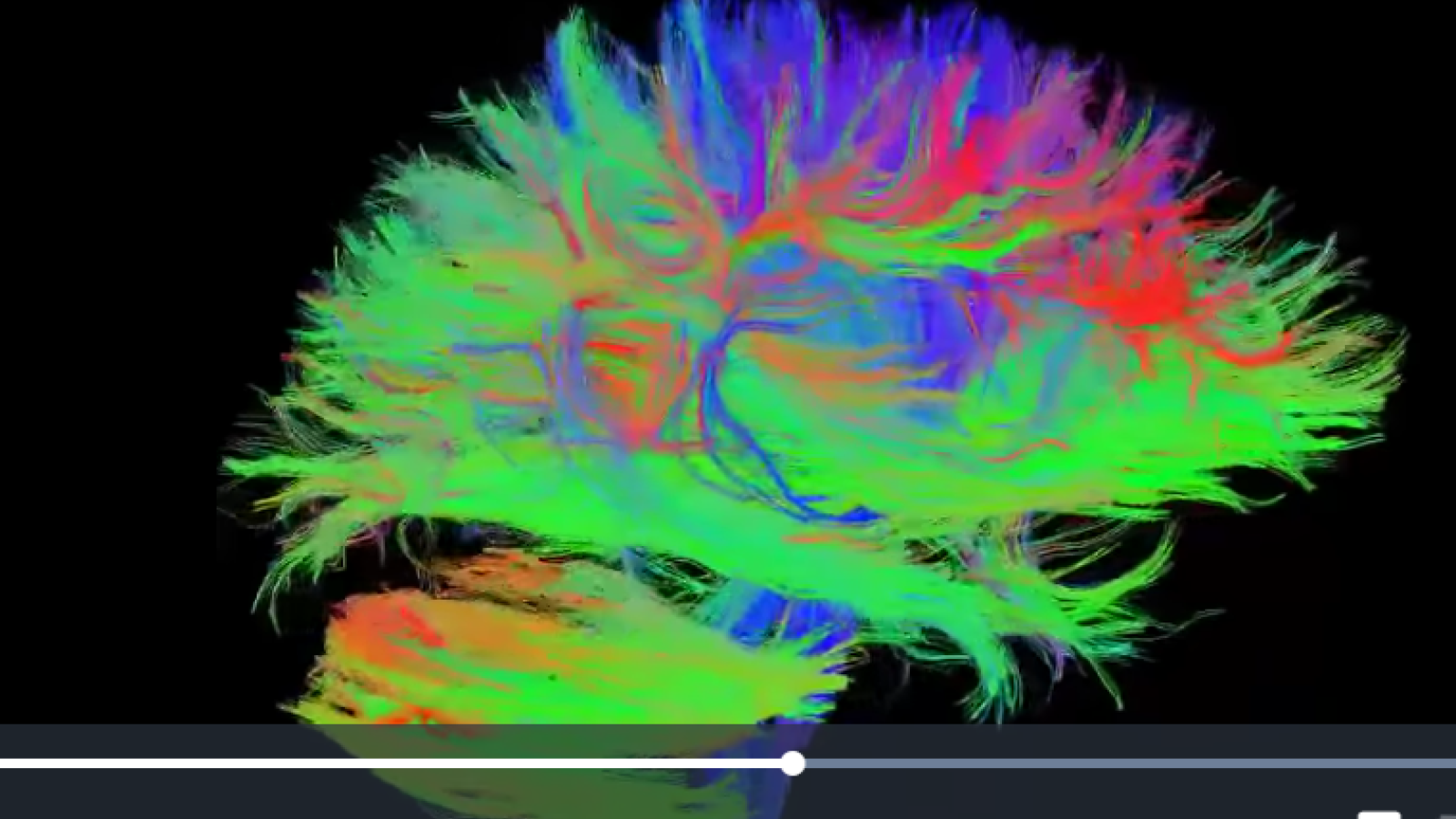 Connectome du cerveau humain