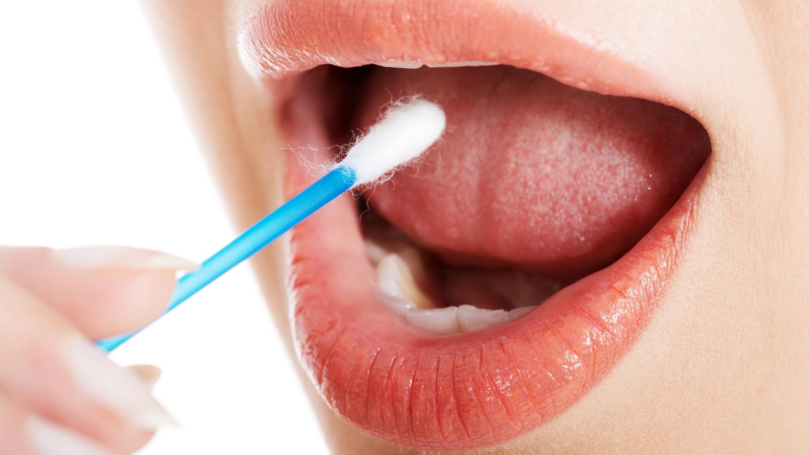 Coton tige pour faire un prélèvement dans la bouche