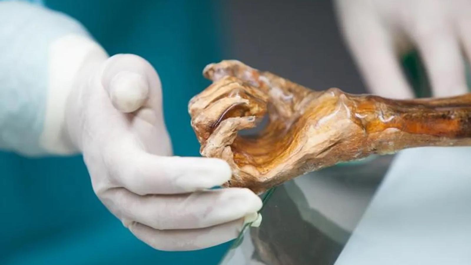 otzi-microbiome.jpg