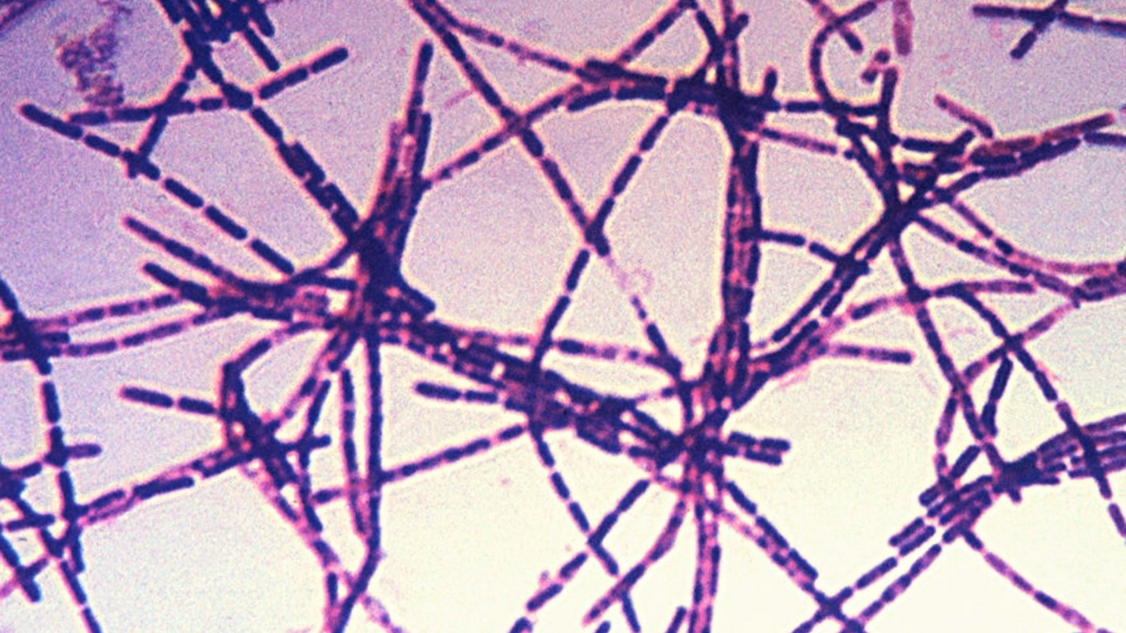 1280px-bacillus_anthracis_gram.jpg