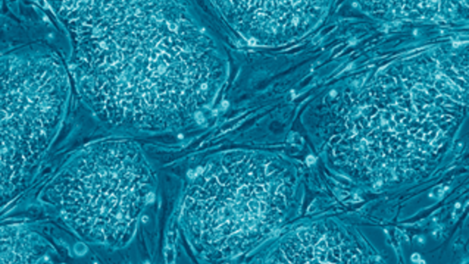 319px-human_embryonic_stem_cells.png
