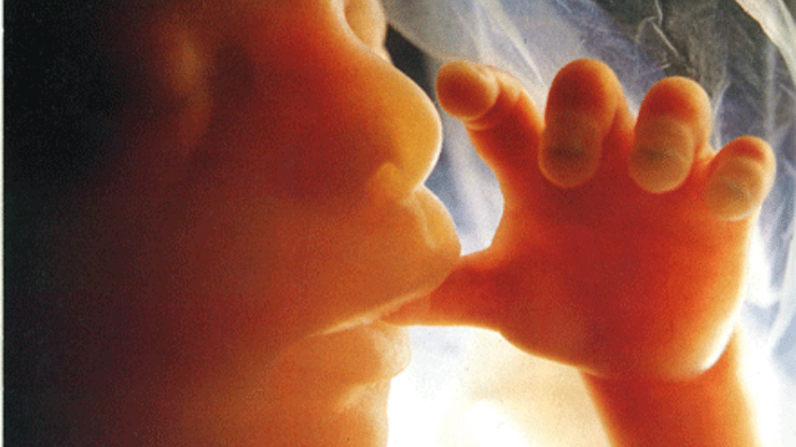 33665_foetus.gif