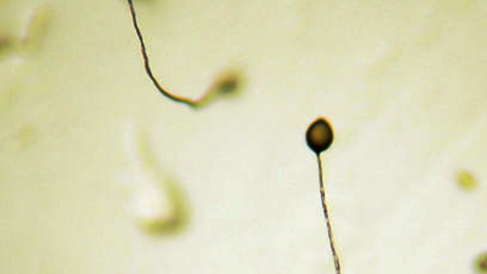 408px-dictyostelium_fruiting_bodies.jpg