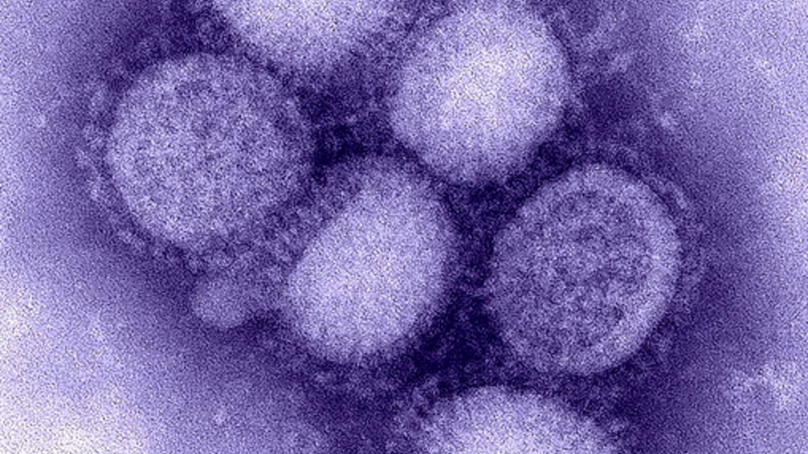 509px-H1N1_influenza_virus.jpg