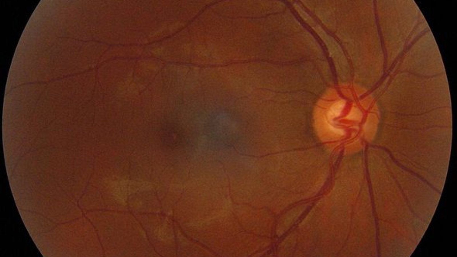 590px-retinography.jpg