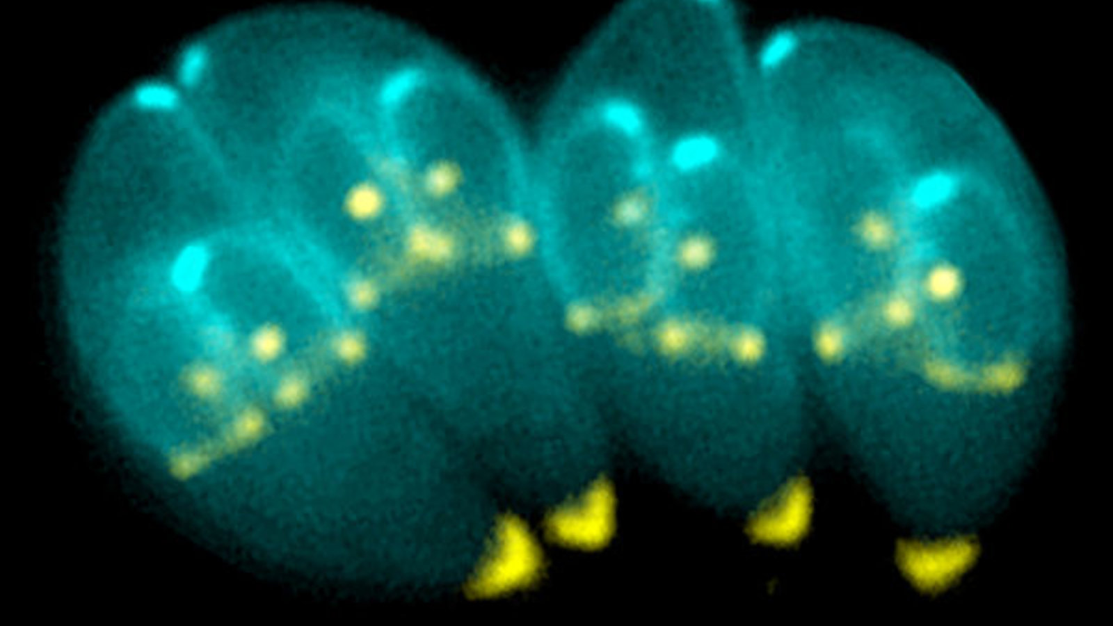 600px-toxoplasma_gondii.jpg