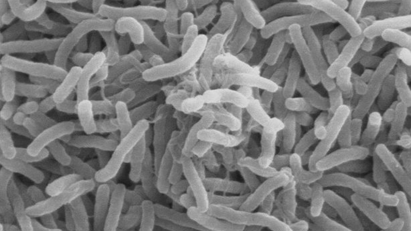 614px-cholera_bacteria_sem.jpg