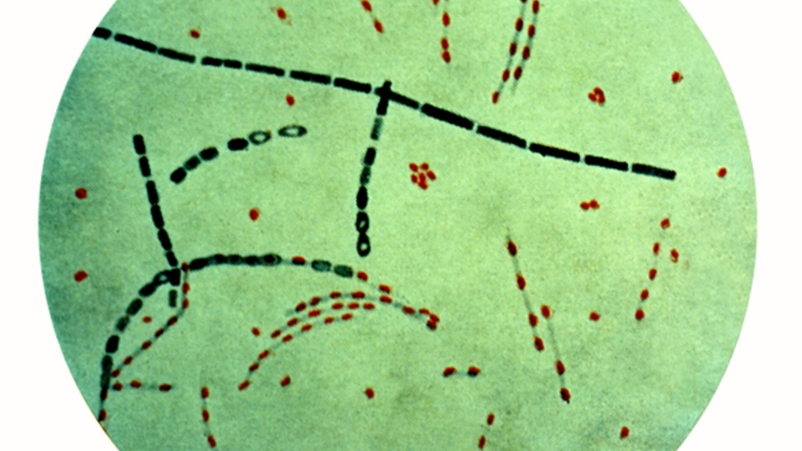 654px-bacillus_anthracis.jpg