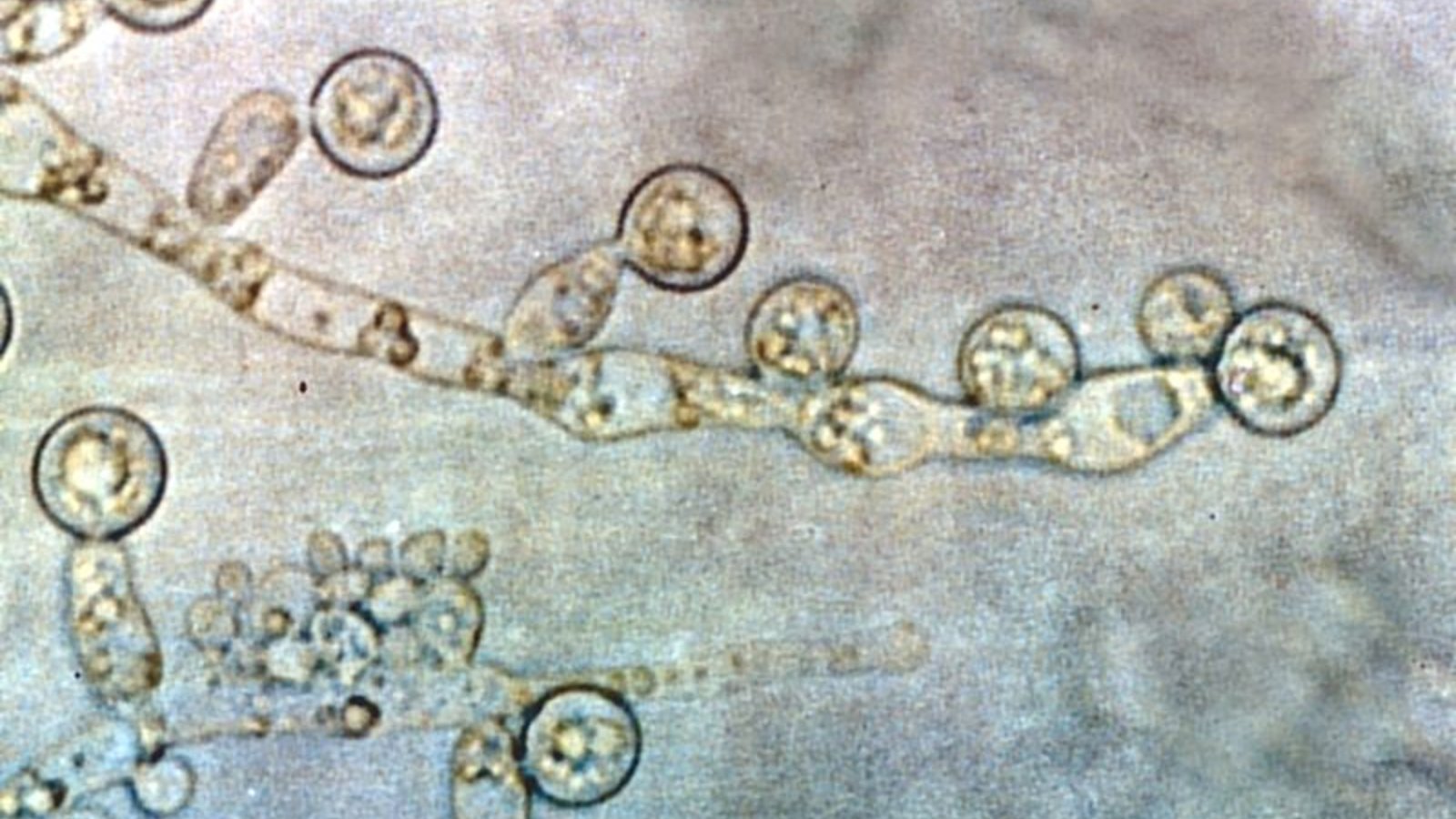 800px-candida_albicans_2.jpg