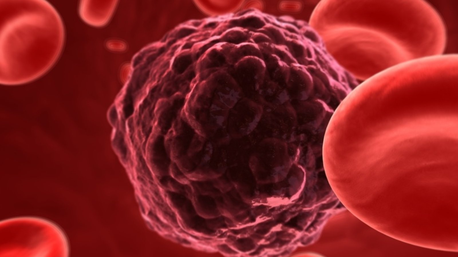 DT_tumorcell.jpg