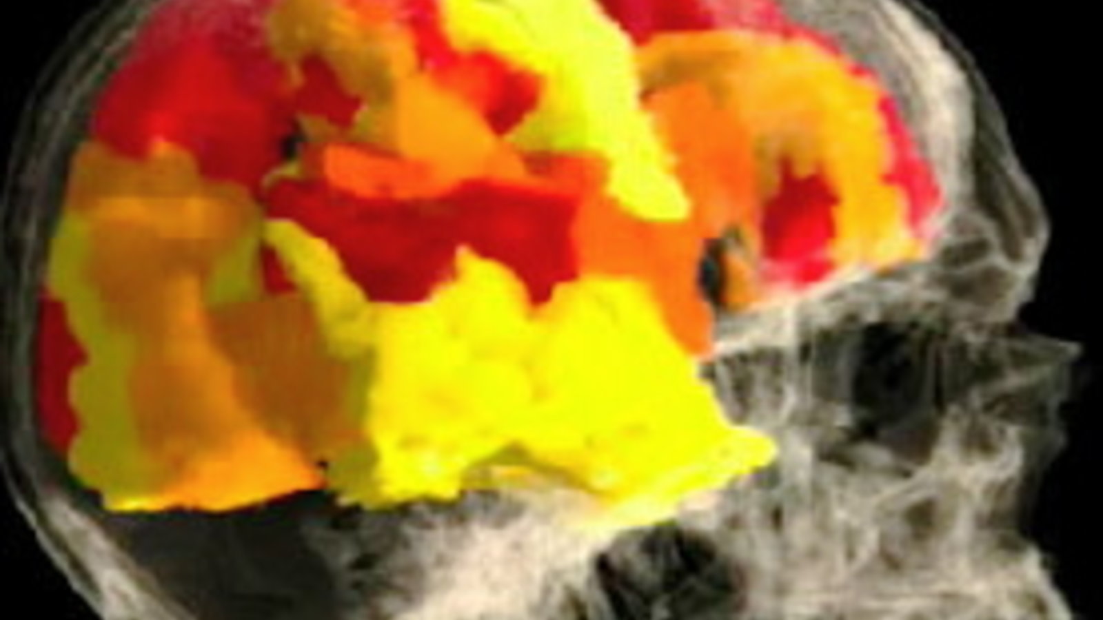 an-image-of-the-brain-of--008.jpg