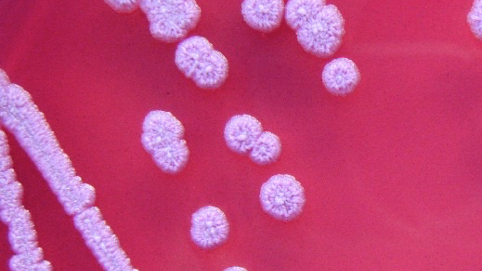 bacterioe-burkholderia.jpg