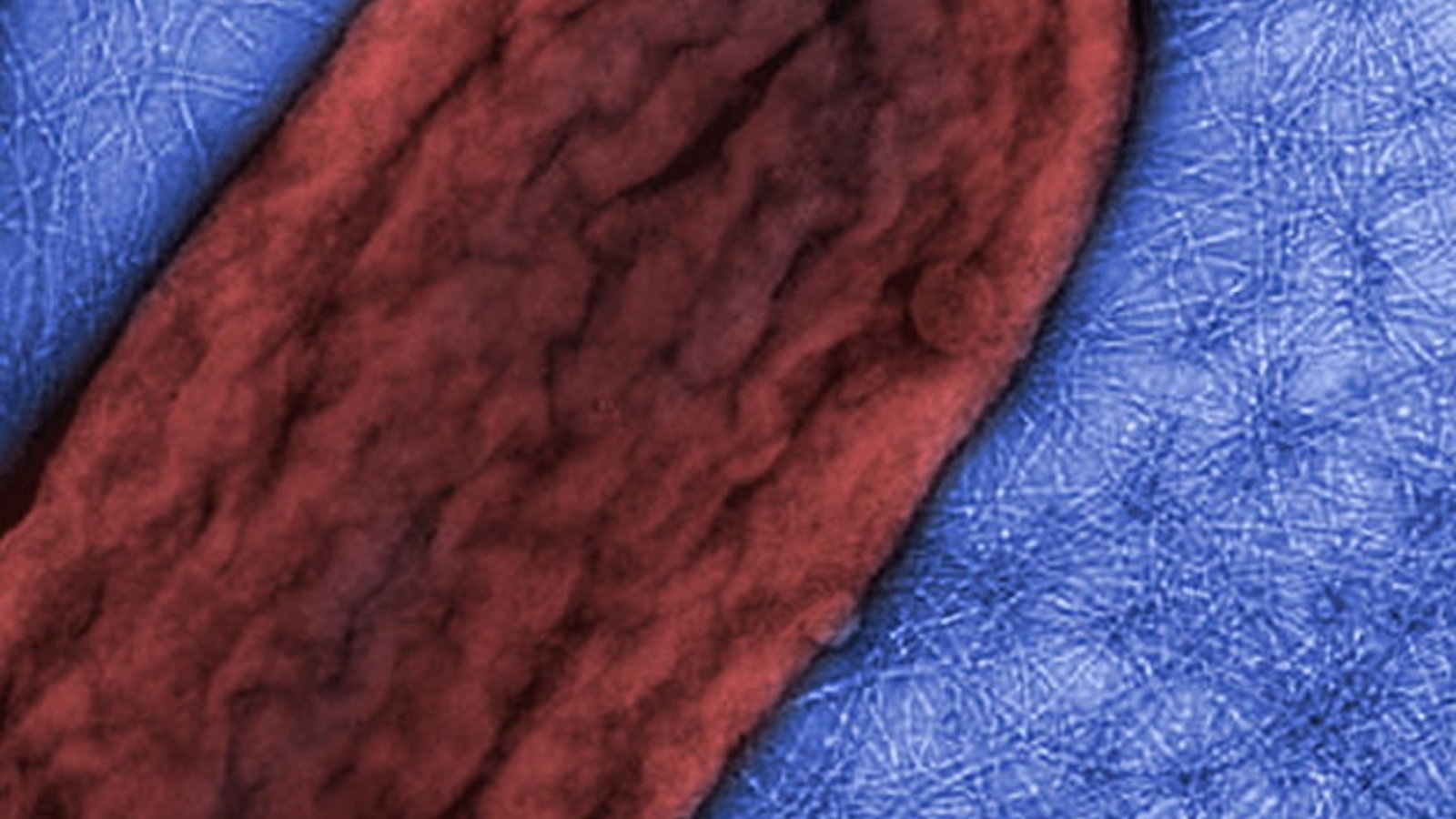 biological-nanowireszoom.jpg