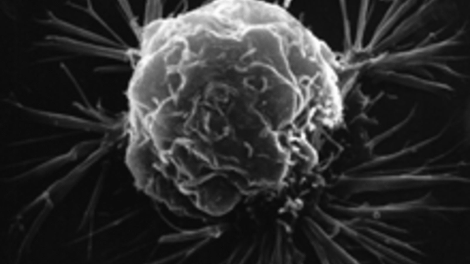 cellule_cancereuse_nih-nationalcancerinstitute.gif