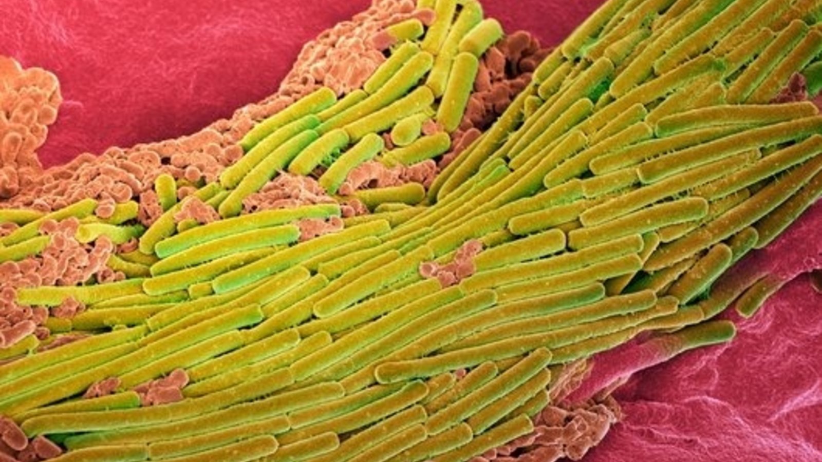 clostridium_difficile_adhere_a_la_surface_de_lintestin.jpg