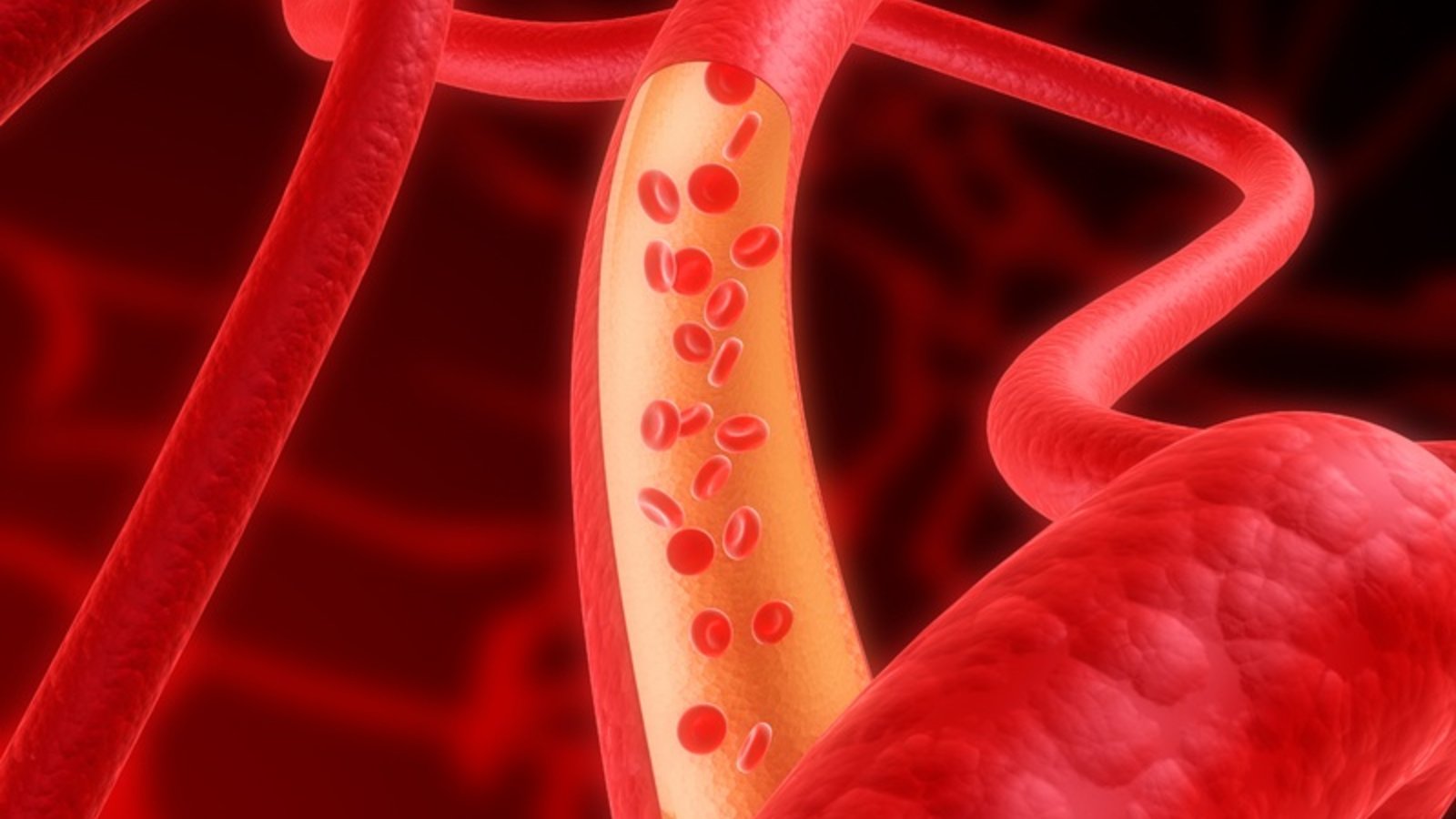 dt_artery.jpg