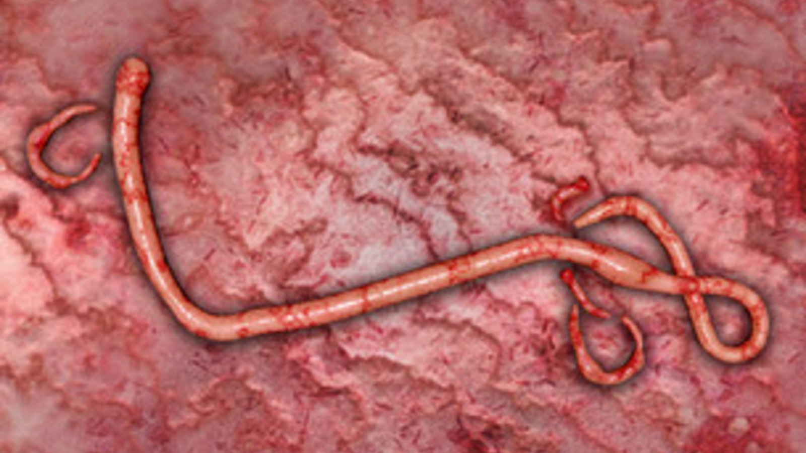 ebola-dreamstime_xs_46056907.jpg