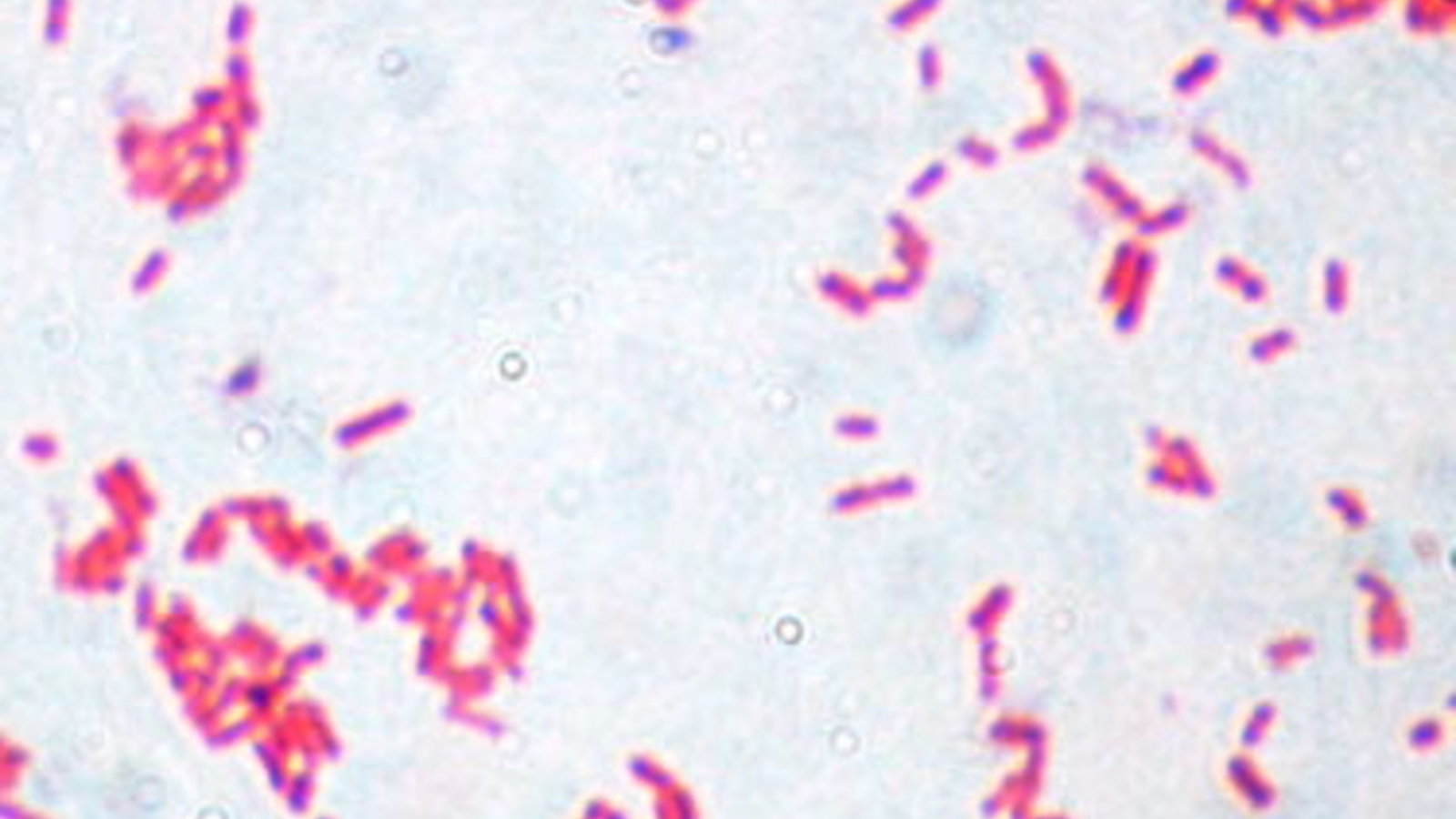 escherichia_coli_gram.jpg