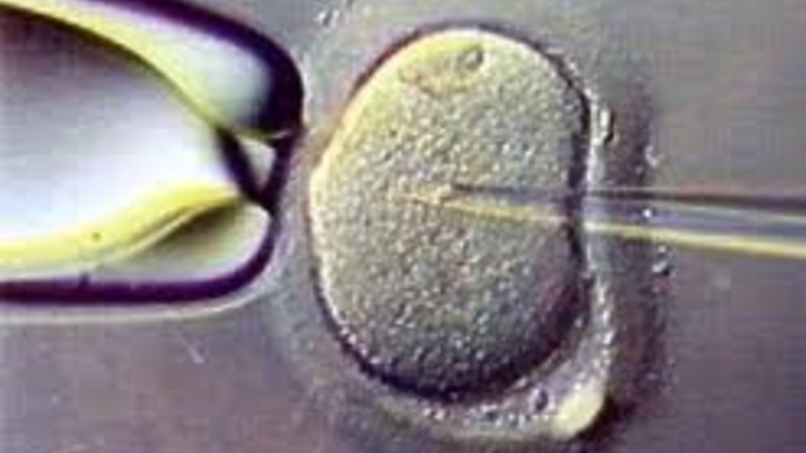 fecondation_in_vitro.jpg