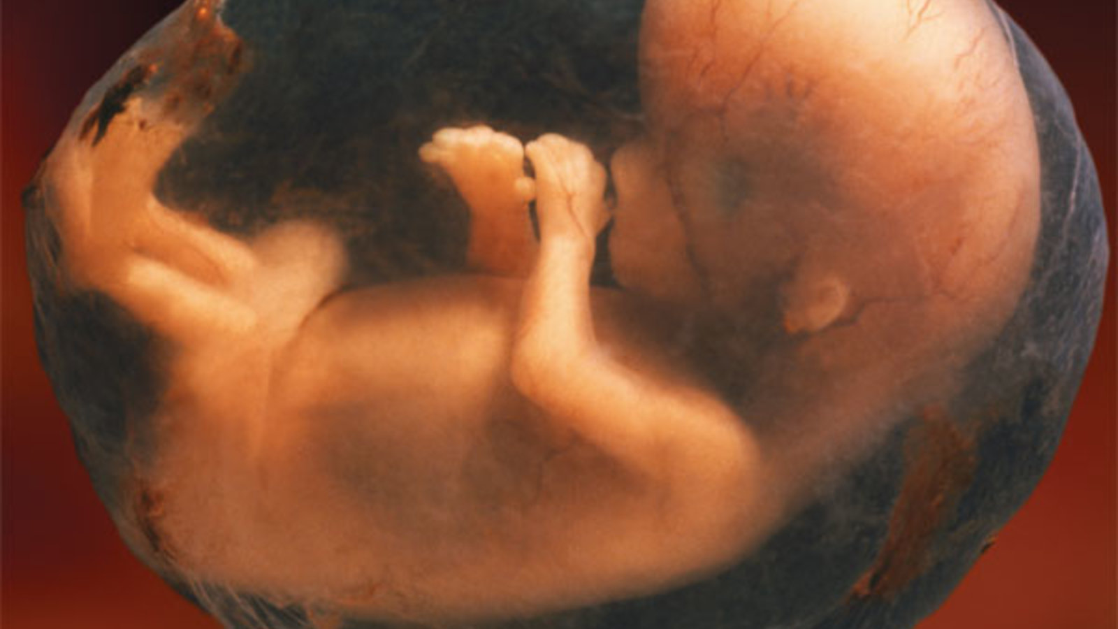 fetus_amniotic_sac.jpg