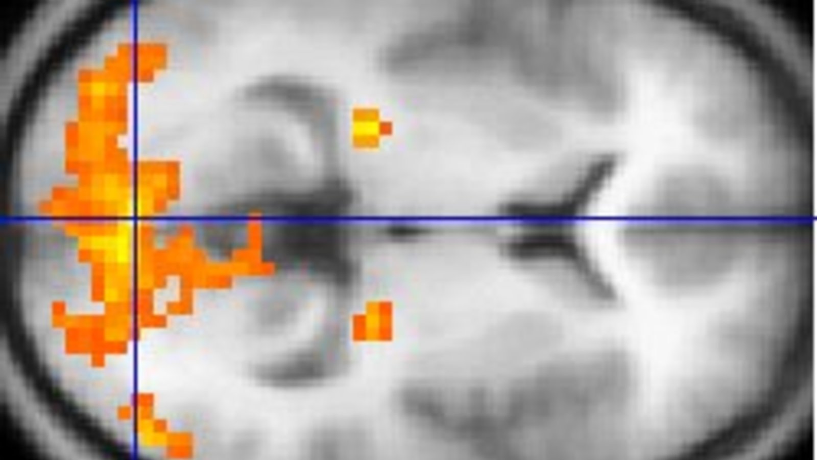 fmri.jpg