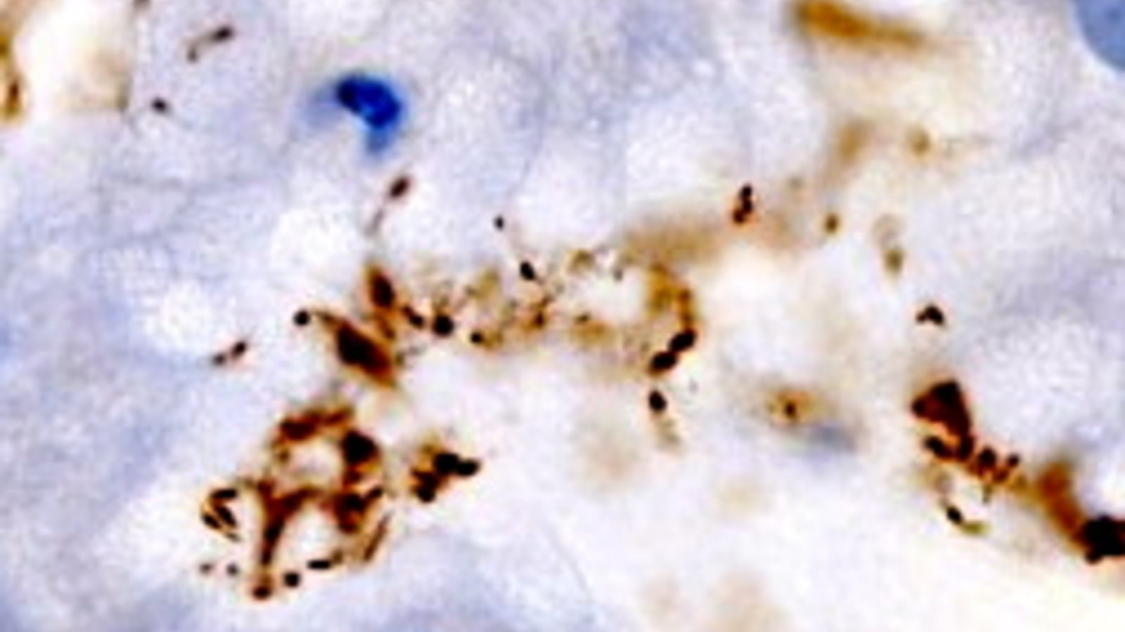 helicobacter-pylori.jpg