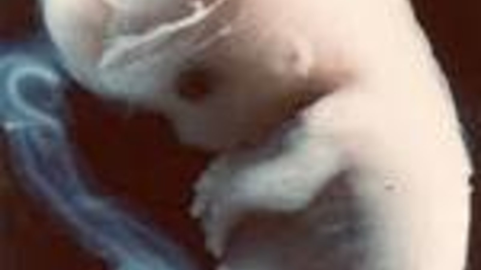 images_foetus.jpg