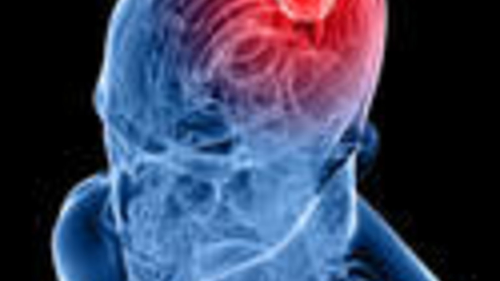 lesion_cerveau.jpg