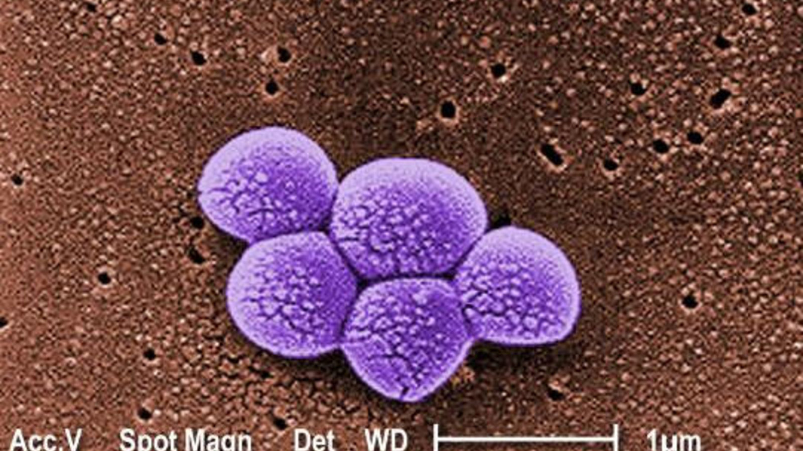 mrsa_sem_9994_lores.jpg